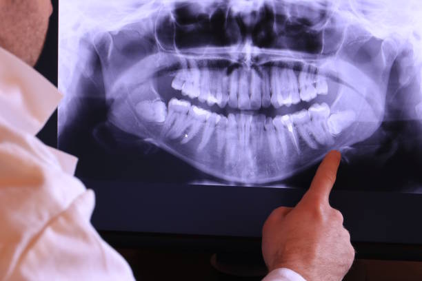 Best Emergency Gum Treatment in Soh Ogden, UT